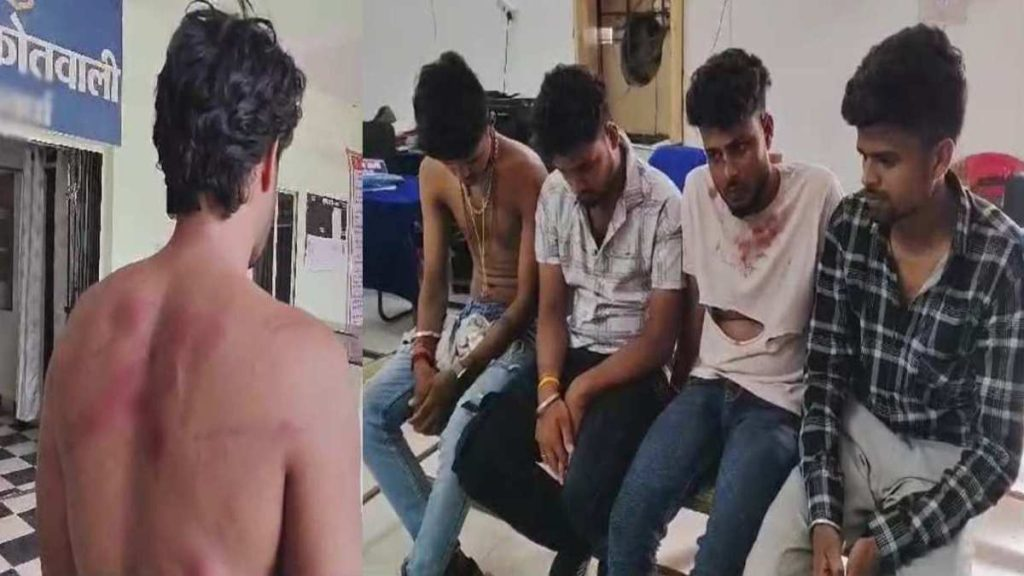 साले ने दोस्तों के साथ मिलकर अपने जीजा को कमरे में बंद कर बेरहमी से पीटा, प्राइवेट पार्ट को भी की जलाने की कोशिश