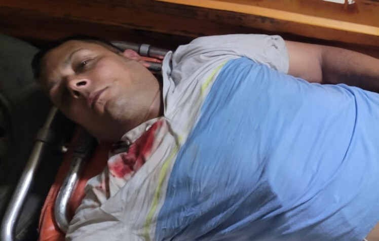 PALM MALL से लहूलुहान हालत में निकला युवक, अस्पताल दाखिल